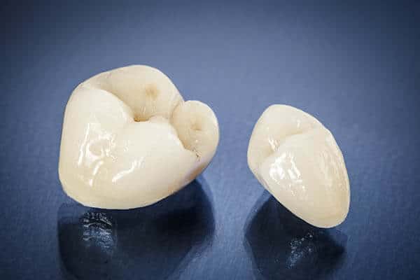 Closeup of Dental Crowns